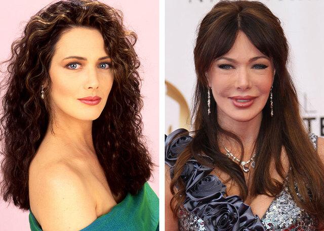 Hunter Tylo believes women should never be shamed for using surgery to maintain their confidence in Hollywood.