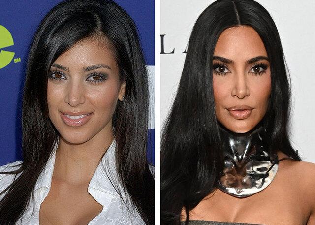 Kim Kardashian confessed her extreme dedication to beauty, including late-night lasers to stay looking young.