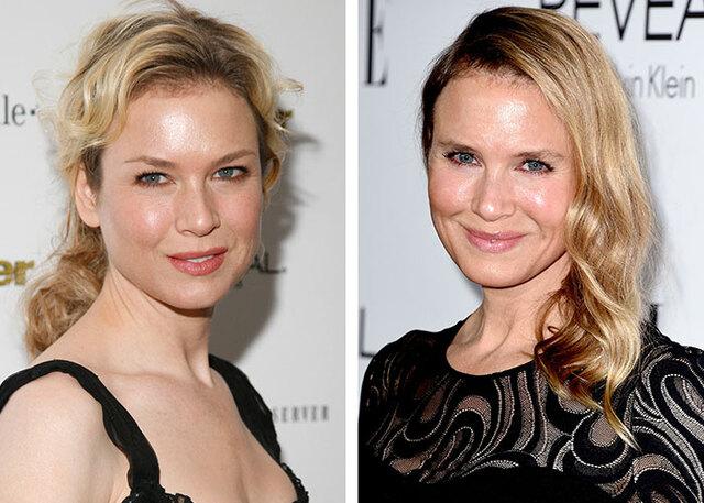 Renée Zellweger dismissed surgery rumors by crediting her "unrecognizable" look to a healthier, happier lifestyle.