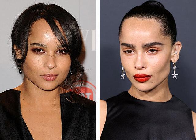 Zoë Kravitz remains at the center of speculation regarding subtle cheek and eye enhancements to her unique face.