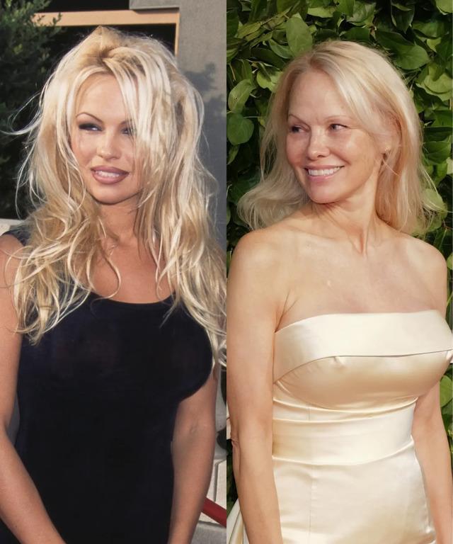 Pamela Anderson is leading a natural beauty revolution by embracing a fresh-faced and makeup-free look.