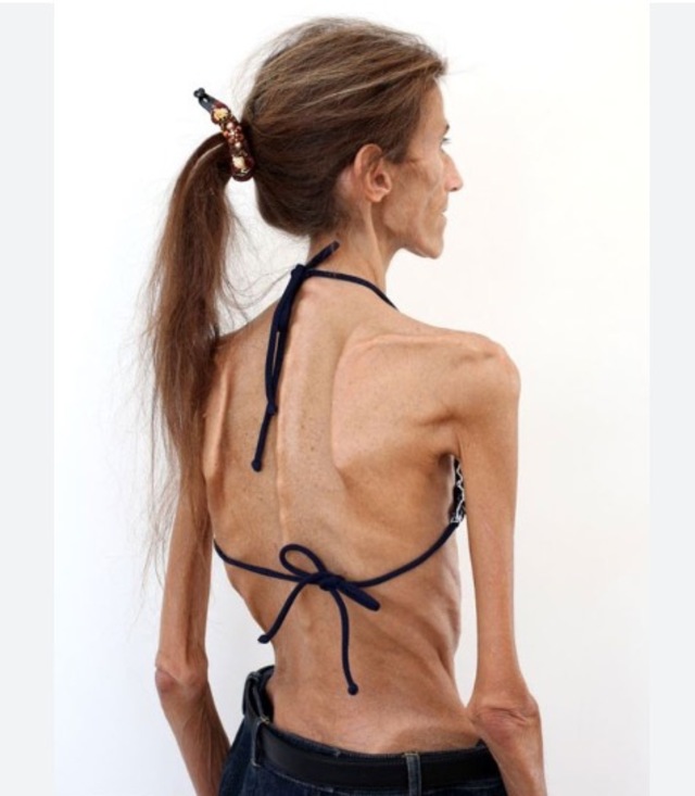 In her twenties, Valeria entered the professional modeling world—an industry where bodies are frequently treated as currency