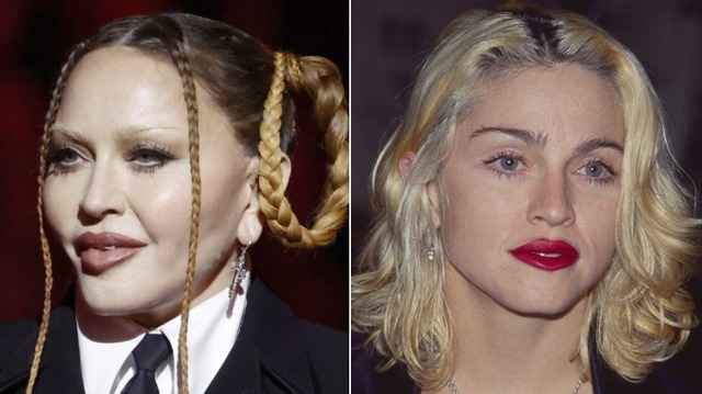 Madonna remains the eternal queen of reinvention, constantly challenging the world to debate the boundaries between artistry and surgery.