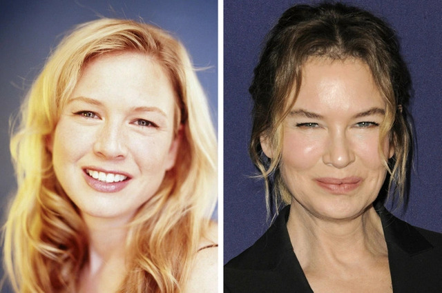 Renée Zellweger sparked a global conversation about beauty pressures after returning to the spotlight with a new look.
