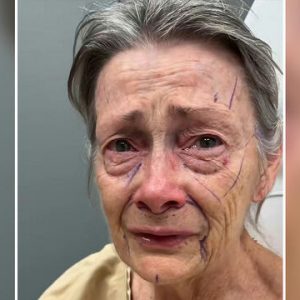 THE BEVERLY HILLS TIME MACHINE: How One Surgeon’s ‘Invisible Touch’ Is Redefining the 70-Year-Old Face