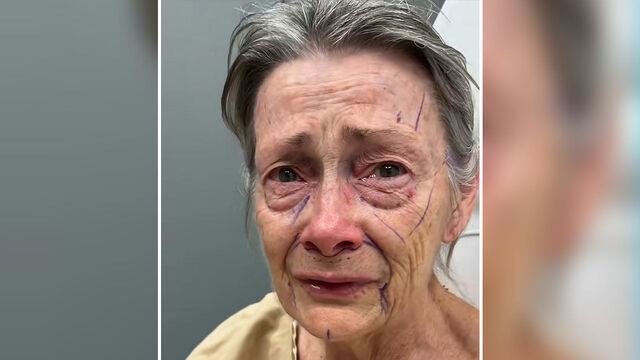 THE BEVERLY HILLS TIME MACHINE: How One Surgeon’s ‘Invisible Touch’ Is Redefining the 70-Year-Old Face