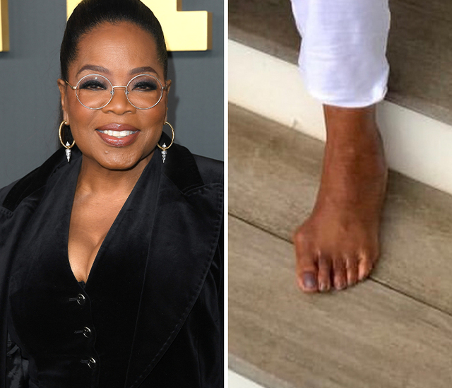 The Bunionette Rumor of Oprah Winfrey
