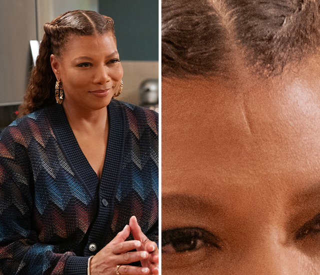 The Childhood Tag Scar of Queen Latifah