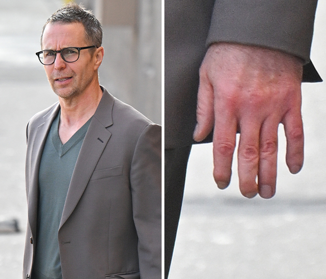 The Reconstructed Fingers of Sam Rockwell