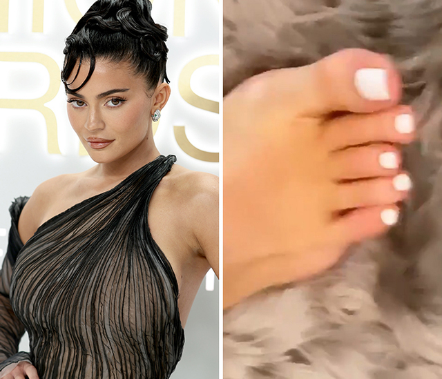 The Viral Broken Toe of Kylie Jenner
