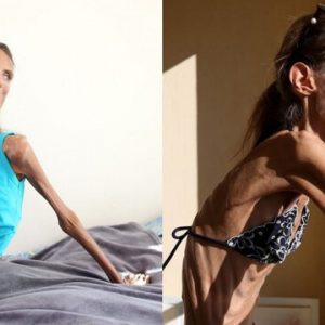 The Weight of Truth: Valeria Levitin’s Battle Against the Deadly Illusion of Perfection