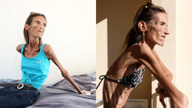 The Weight of Truth: Valeria Levitin’s Battle Against the Deadly Illusion of Perfection