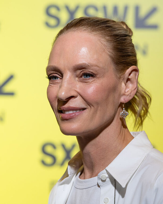 Uma Thurman highlighting the anatomical difficulty of maintaining volume in the periorbital zone.