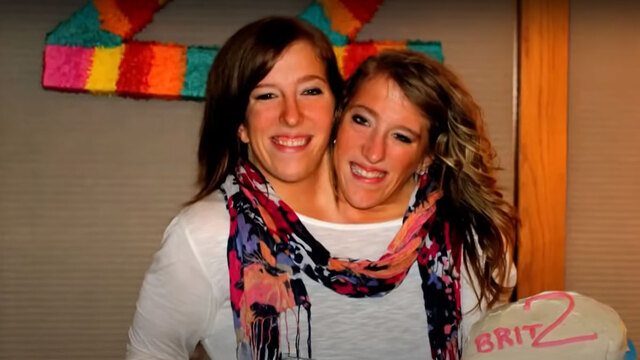 According to data from the Children’s Hospital of Philadelphia, conjoined twins occur once in every 50,000 to 60,000 births.