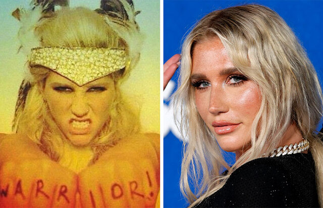 Ke$ha: The pop star crafted a headdress and jewelry using over a thousand teeth sent by fans.