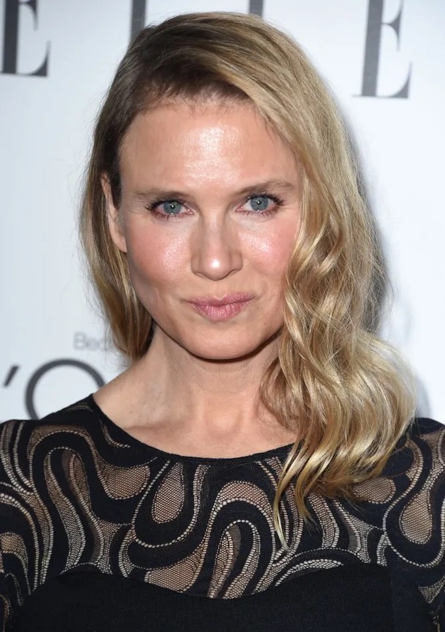 One of the more unique turns in the recent Zellweger discourse is the shift from purely cosmetic criticism to medical concern