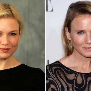 The Zellweger Paradox: Unmasking Hollywood’s Obsession with the "Changing Face" of Fame