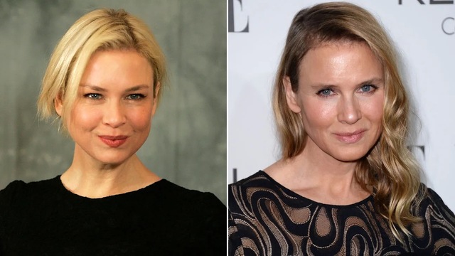 The Zellweger Paradox: Unmasking Hollywood’s Obsession with the "Changing Face" of Fame