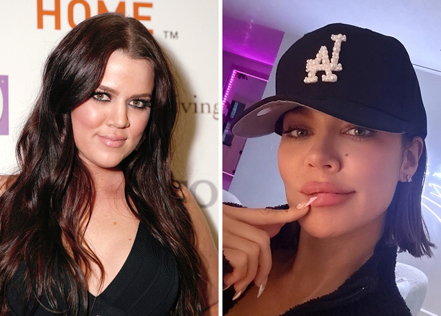 Khloé Kardashian: Navigating the Global Microscope of Facial Evolution