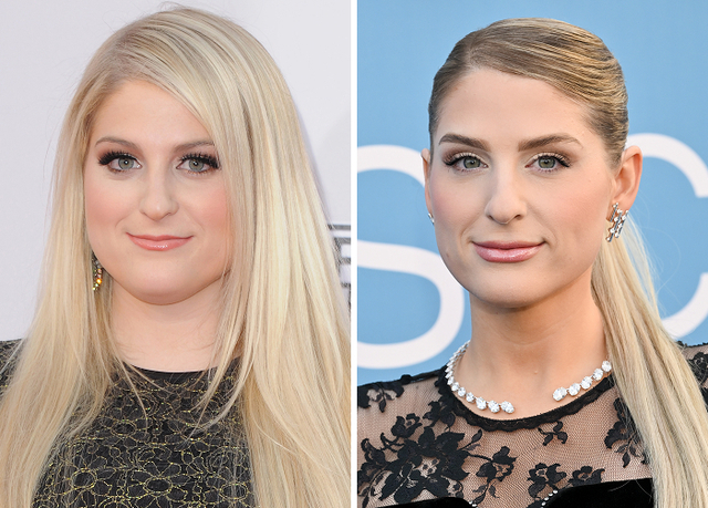 Meghan Trainor: The Painful Reality of the Frozen Smile