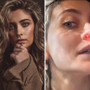 The Eroding Mask: Unveiling the Graphic Reality and Hidden Costs of ‘Coke Nose’