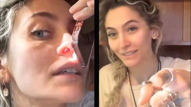 The celebrity mirror has reflected this reality for years. Paris Jackson recently shared a video showing a hole that had opened inside her nose