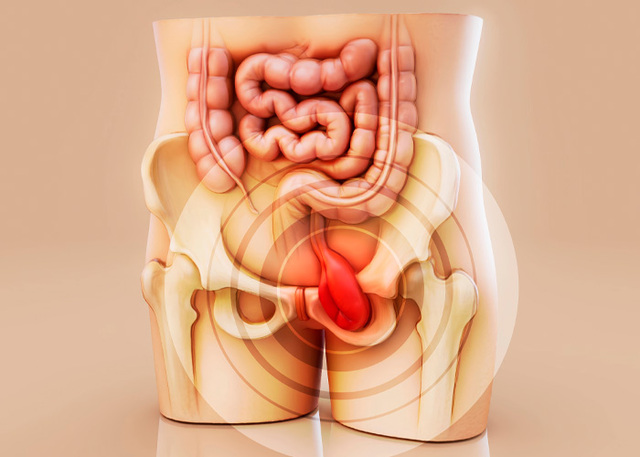 When you strain, you increase the pressure on the rectal blood vessels, causing them to swell, itch, and bleed