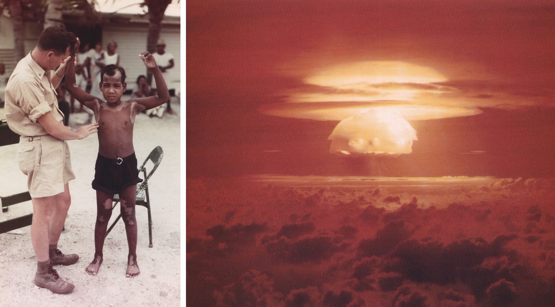 The Impact of Nuclear Weapons on Children